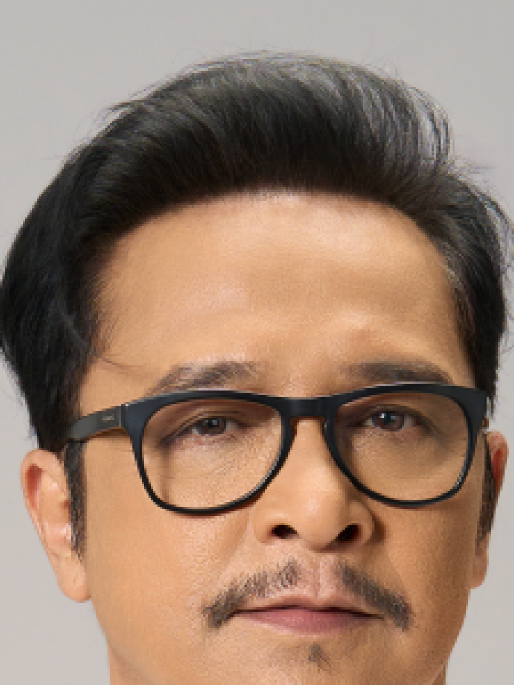 Sesudah - Hair Transplant