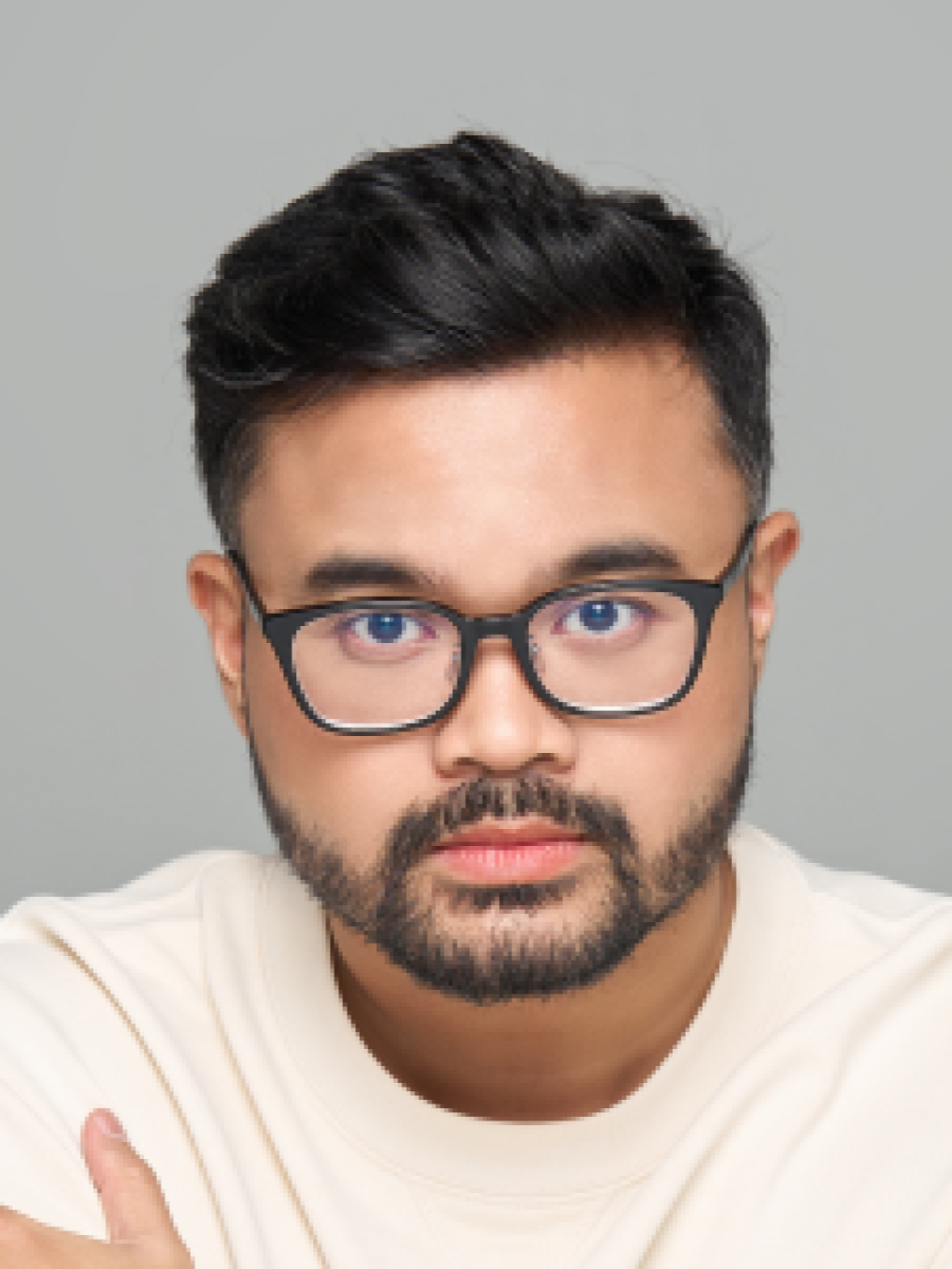 Sesudah - Hair Transplant