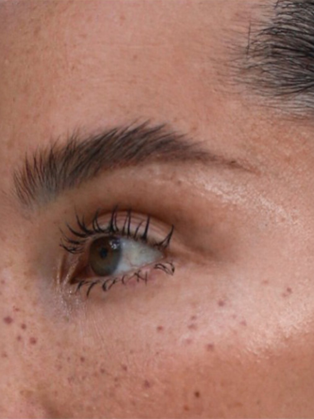 Sesudah - Eyebrow Transplant